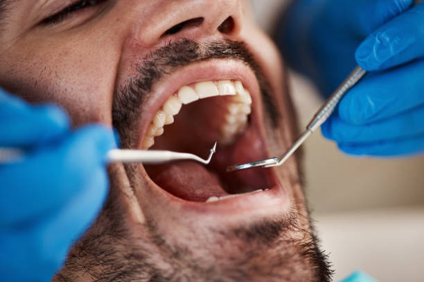 Dentist for Dental Trauma